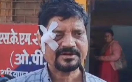 पुलिस वाले पर वकील की आंखे फोड़ने का आरोप, मानवाधिकार आयोग करेगी जांच