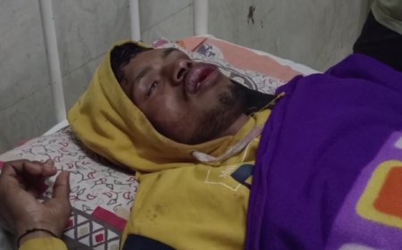 किस डे के दिन - प्रेमी के होठों को पीटकर फुलाया, आपत्तिजनक स्थिति पकड़, प्रेमी की पिटाई