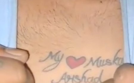 सीने पर लिखवाया "MY LOVE MUSKAN",2022 में ब्रेकअप, गुस्साए पिता ने मारी गोली, सदर अस्पताल में चल रहा इलाज
