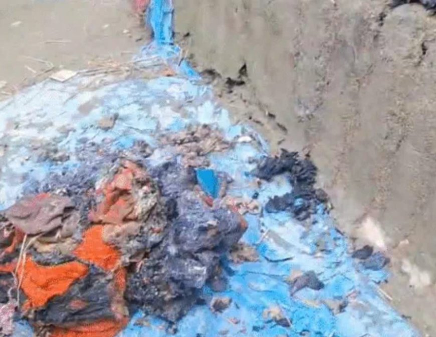 कटिहार में रास्ते के विवाद में पिता-पुत्र को जिंदा जलाया, आग बुझाने को जमीन पर लोटता रहा मासूम...मौत, पिता ICU में भर्ती