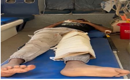 कार्टन से बांधा गया टूटा पैर! बिहार के अस्पताल की तस्वीर ने खोली स्वास्थ्य व्यवस्था की पोल